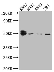 Western Blot<br />Positive WB detected in: K562 whole cell lysate, 293T whole cell lysate, A549 whole cell lysate, HEK293 whole cell lysate<br />All lanes: Wilms Tumor Protein antibody at 1:1000<br />Secondary<br />Goat polyclonal to rabbit IgG at 1/50000 dilution<br />Predicted band size: 50, 48, 48, 49, 35, 57, 56, 34 kDa<br />Observed band size: 50 kDa<br />