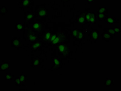 Immunofluorescence staining of MCF7 Cells with CSB-RA988421A0HU at 1:50, counter-stained with DAPI. The cells were fixed in 4% formaldehyde, permeated by 0.2% TritonX-100, and blocked in 10% normal Goat Serum. The cells were then incubated with the antibody overnight at 4℃. Nuclear DNA was labeled in blue with DAPI. The secondary antibody was FITC-conjugated AffiniPure Goat Anti-Rabbit IgG (H+L).