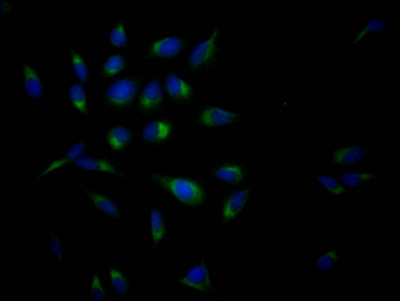 Immunofluorescence staining of Hela Cells with CSB-RA994273A0HU at 1:50, counter-stained with DAPI. The cells were fixed in 4% formaldehyde, permeated by 0.2% TritonX-100, and blocked in 10% normal Goat Serum. The cells were then incubated with the antibody overnight at 4℃. Nuclear DNA was labeled in blue with DAPI. The secondary antibody was FITC-conjugated AffiniPure Goat Anti-Rabbit IgG (H+L).