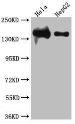 Western Blot<br />
Positive WB detected in: Hela whole cell lysate, HepG2 whole cell lysate<br />
All lanes: DNA Ligase I antibody at 1:1000<br />
Secondary<br />
Goat polyclonal to rabbit IgG at 1/50000 dilution<br />
Predicted band size: 102, 89, 99 kDa<br />
Observed band size: 140 kDa<br />