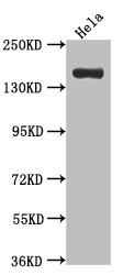 Western Blot<br />Positive WB detected in: Hela whole cell lysate<br />All lanes: Xanthine Oxidase antibody at 1:1000<br />Secondary<br />Goat polyclonal to rabbit IgG at 1/50000 dilution<br />Predicted band size: 147 kDa<br />Observed band size: 147 kDa<br />