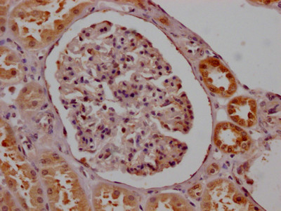 IHC image of CSB-RA567382A0HU diluted at 1:100 and staining in paraffin-embedded human kidney tissue performed on a Leica BondTM system. After dewaxing and hydration, antigen retrieval was mediated by high pressure in a citrate buffer (pH 6.0). Section was blocked with 10% normal goat serum 30min at RT. Then primary antibody (1% BSA) was incubated at 4℃ overnight. The primary is detected by a Goat anti-rabbit IgG polymer labeled by HRP and visualized using 0.05% DAB.