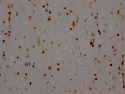 IHC image of CSB-RA273277A0HU diluted at 1:100 and staining in paraffin-embedded human brain tissue performed on a Leica BondTM system. After dewaxing and hydration, antigen retrieval was mediated by high pressure in a citrate buffer (pH 6.0). Section was blocked with 10% normal goat serum 30min at RT. Then primary antibody (1% BSA) was incubated at 4℃ overnight. The primary is detected by a Goat anti-rabbit IgG polymer labeled by HRP and visualized using 0.05% DAB.