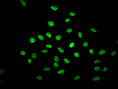 Immunofluorescence staining of Hela Cells with CSB-RA273277A0HU at 1:50, counter-stained with DAPI. The cells were fixed in 4% formaldehyde, permeated by 0.2% TritonX-100, and blocked in 10% normal Goat Serum. The cells were then incubated with the antibody overnight at 4℃. Nuclear DNA was labeled in blue with DAPI. The secondary antibody was FITC-conjugated AffiniPure Goat Anti-Rabbit IgG (H+L).