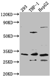 Western Blot<br />
Positive WB detected in: 293 whole cell lysate, THP-1 whole cell lysate, HepG2 whole cell lysate<br />
All lanes: COMT Antibody at 1:1000<br />
Secondary<br />
Goat polyclonal to rabbit IgG at 1/50000 dilution<br />
Predicted band size: 31, 25 kDa<br />
Observed band size: 31 kDa<br />