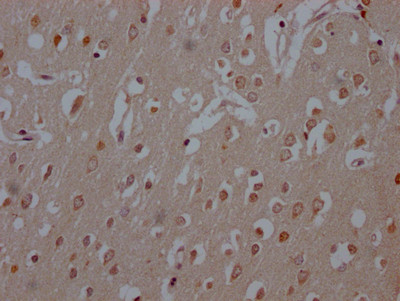 IHC image of CSB-RA909081A0HU diluted at 1:100 and staining in paraffin-embedded human brain tissue performed on a Leica BondTM system. After dewaxing and hydration, antigen retrieval was mediated by high pressure in a citrate buffer (pH 6.0). Section was blocked with 10% normal goat serum 30min at RT. Then primary antibody (1% BSA) was incubated at 4℃ overnight. The primary is detected by a Goat anti-rabbit IgG polymer labeled by HRP and visualized using 0.05% DAB.