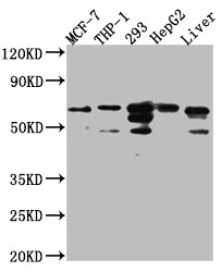 Western Blot<br />Positive WB detected in: MCF-7 whole cell lysate, THP-1 whole cell lysate, 293 whole cell lysate, HepG2 whole cell lysate, Mouse Liver whole cell lysate<br />All lanes: FAAH1 Antibody at 1:1000<br />Secondary<br />Goat polyclonal to rabbit IgG at 1/50000 dilution<br />Predicted band size: 64 kDa<br />Observed band size: 64 kDa<br />