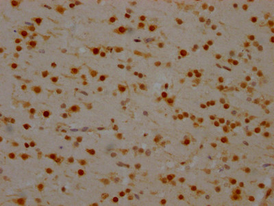 IHC image of CSB-RA984434A0HU diluted at 1:100 and staining in paraffin-embedded human brain tissue performed on a Leica BondTM system. After dewaxing and hydration, antigen retrieval was mediated by high pressure in a citrate buffer (pH 6.0). Section was blocked with 10% normal goat serum 30min at RT. Then primary antibody (1% BSA) was incubated at 4℃ overnight. The primary is detected by a Goat anti-rabbit IgG polymer labeled by HRP and visualized using 0.05% DAB.