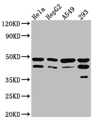 Western Blot<br />Positive WB detected in: Hela whole cell lysate, HepG2 whole cell lysate, A549 whole cell lysate, 293 whole cell lysate<br />All lanes: GSK3 beta Antibody at 1:1000<br />Secondary<br />Goat polyclonal to rabbit IgG at 1/50000 dilution<br />Predicted band size: 47, 49 kDa<br />Observed band size: 47 kDa<br />
