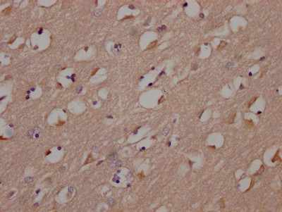 IHC image of CSB-RA699767A0HU diluted at 1:100 and staining in paraffin-embedded human brain tissue performed on a Leica BondTM system. After dewaxing and hydration, antigen retrieval was mediated by high pressure in a citrate buffer (pH 6.0). Section was blocked with 10% normal goat serum 30min at RT. Then primary antibody (1% BSA) was incubated at 4℃ overnight. The primary is detected by a Goat anti-rabbit IgG polymer labeled by HRP and visualized using 0.05% DAB.