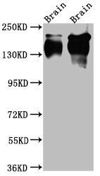 Western Blot<br />
Positive WB detected in: Rat Brain whole cell lysate, Mouse Brain whole cell lysate<br />
All lanes: TrkA Antibody at 1:1000<br />
Secondary<br />
Goat polyclonal to rabbit IgG at 1/50000 dilution<br />
Predicted band size: 88, 87, 84, 78 kDa<br />
Observed band size: 145 kDa<br />