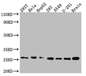 Western Blot<br />Positive WB detected in: 293T whole cell lysate, Hela whole cell lysate, HepG2 whole cell lysate 293 whole cell lysate, A549 whole cell lysate, U-251 whole cell lysate, Mouse Brain whole cell lysate<br />All lanes: Id1 antibody at 1:1000<br />Secondary<br />Goat polyclonal to rabbit IgG at 1/50000 dilution<br />Predicted band size: 17, 16 kDa<br />Observed band size: 26 kDa<br />