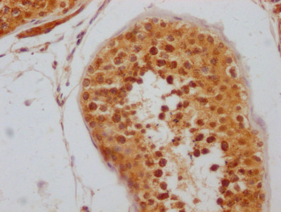 IHC image of CSB-RA227095A0HU diluted at 1:100 and staining in paraffin-embedded human testis tissue performed on a Leica BondTM system. After dewaxing and hydration, antigen retrieval was mediated by high pressure in a citrate buffer (pH 6.0). Section was blocked with 10% normal goat serum 30min at RT. Then primary antibody (1% BSA) was incubated at 4℃ overnight. The primary is detected by a Goat anti-rabbit IgG polymer labeled by HRP and visualized using 0.05% DAB.