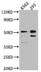 Western Blot<br />
Positive WB detected in: K562 whole cell lysate, 293 whole cell lysate<br />
All lanes: Caspase-2 antibody at 1:1000<br />
Secondary<br />
Goat polyclonal to rabbit IgG at 1/50000 dilution<br />
Predicted band size: 51, 35, 11 kDa<br />
Observed band size: 51 kDa<br />