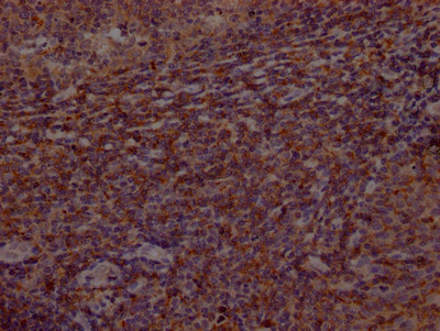 IHC image of CSB-RA553167A0HU diluted at 1:100 and staining in paraffin-embedded human tonsil tissue performed on a Leica BondTM system. After dewaxing and hydration, antigen retrieval was mediated by high pressure in a citrate buffer (pH 6.0). Section was blocked with 10% normal goat serum 30min at RT. Then primary antibody (1% BSA) was incubated at 4℃ overnight. The primary is detected by a Goat anti-rabbit IgG polymer labeled by HRP and visualized using 0.05% DAB.