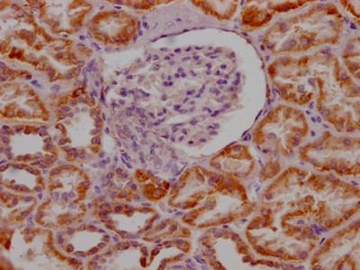 IHC image of CSB-RA250615A0HU diluted at 1:100 and staining in paraffin-embedded human kidney tissue performed on a Leica BondTM system. After dewaxing and hydration, antigen retrieval was mediated by high pressure in a citrate buffer (pH 6.0). Section was blocked with 10% normal goat serum 30min at RT. Then primary antibody (1% BSA) was incubated at 4℃ overnight. The primary is detected by a Goat anti-rabbit IgG polymer labeled by HRP and visualized using 0.05% DAB.