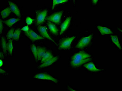 Immunofluorescence staining of Hela Cells with CSB-RA213218A0HU at 1:50, counter-stained with DAPI. The cells were fixed in 4% formaldehyde, permeated by 0.2% TritonX-100, and blocked in 10% normal Goat Serum. The cells were then incubated with the antibody overnight at 4℃. Nuclear DNA was labeled in blue with DAPI. The secondary antibody was FITC-conjugated AffiniPure Goat Anti-Rabbit IgG (H+L).
