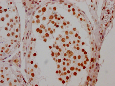 IHC image of CSB-RA279005A0HU diluted at 1:100 and staining in paraffin-embedded human testis tissue performed on a Leica BondTM system. After dewaxing and hydration, antigen retrieval was mediated by high pressure in a citrate buffer (pH 6.0). Section was blocked with 10% normal goat serum 30min at RT. Then primary antibody (1% BSA) was incubated at 4℃ overnight. The primary is detected by a Goat anti-rabbit IgG polymer labeled by HRP and visualized using 0.05% DAB.