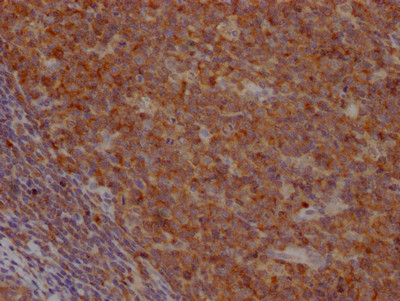 IHC image of CSB-RA833808A0HU diluted at 1:100 and staining in paraffin-embedded human tonsil tissue performed on a Leica BondTM system. After dewaxing and hydration, antigen retrieval was mediated by high pressure in a citrate buffer (pH 6.0). Section was blocked with 10% normal goat serum 30min at RT. Then primary antibody (1% BSA) was incubated at 4℃ overnight. The primary is detected by a Goat anti-rabbit IgG polymer labeled by HRP and visualized using 0.05% DAB.