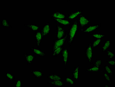 Immunofluorescence staining of Hela Cells with CSB-RA780541A0HU at 1:50, counter-stained with DAPI. The cells were fixed in 4% formaldehyde, permeated by 0.2% TritonX-100, and blocked in 10% normal Goat Serum. The cells were then incubated with the antibody overnight at 4℃. Nuclear DNA was labeled in blue with DAPI. The secondary antibody was FITC-conjugated AffiniPure Goat Anti-Rabbit IgG (H+L).