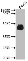 Western Blot<br />
Positive WB detected in: Daudi whole cell lysate<br />
All lanes: CD48 antibody at 1:2000<br />
Secondary<br />
Goat polyclonal to rabbit IgG at 1/50000 dilution<br />
Predicted band size: 28, 20 kDa<br />
Observed band size: 45 kDa<br />