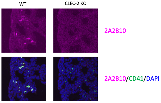 Anti CLEC-2 mAb (Clone 2A2B10) <br>Immunohistochemistry: see datasheet for details
