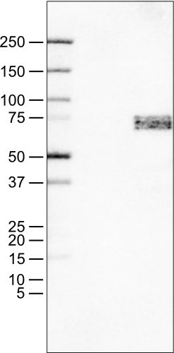 Lane 1: Marker [kDa]<br/>Lane 2: Negative control (vector only transfected HEK293T lysate)<br/>Lane 3: SOX11 Over-expression Lysate (Co-expressed with a C-terminal myc-DDK tag (~3.1 kDa) in mammalian HEK293T cells, LY418895)