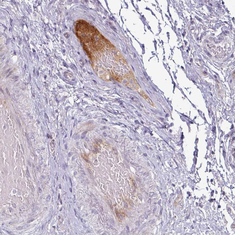 Immunohistochemical staining of human urinary bladder shows moderate positivity in plasma in blood vessels.