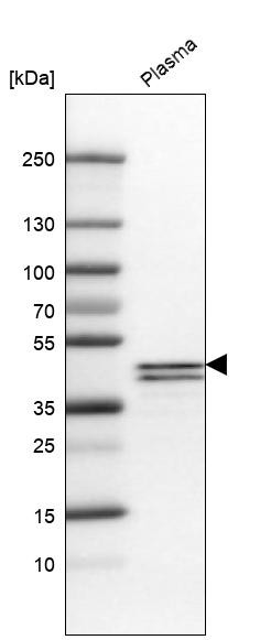Western blot analysis in human plasma.