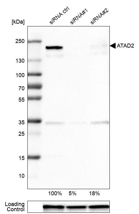 Western blot analysis in U-251MG cells transfected with control siRNA, target specific siRNA probe #1 and #2, using Anti-ATAD2 antibody. Remaining relative intensity is presented. Loading control: Anti-GAPDH.