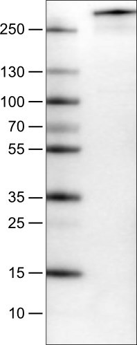Lane 1: Marker [kDa]<br/>Lane 2: Human cell line U-251