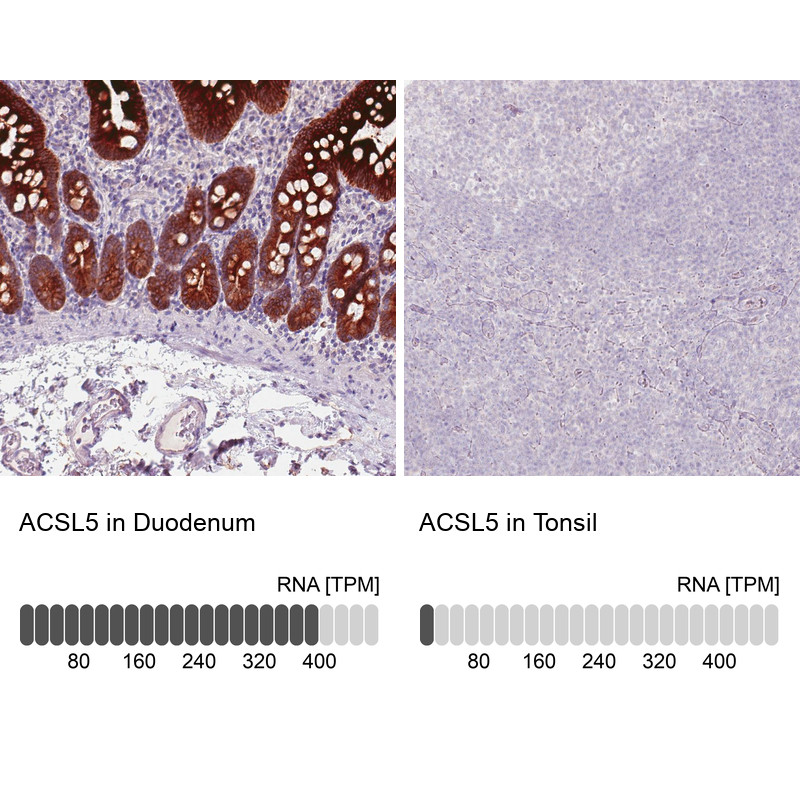 Immunohistochemical staining of human duodenum shows strong cytoplasmic and membrane immunoreactivity in the glandular cells.