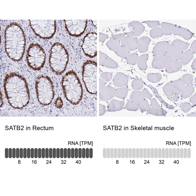 Immunohistochemistry analysis in human rectum and skeletal muscle tissues using AMAb90635 antibody. Corresponding SATB2 RNA-seq data are presented for the same tissues.