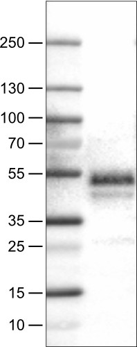 Lane 1: Marker [kDa]<br/>Lane 2: Human tonsil tissue lysate