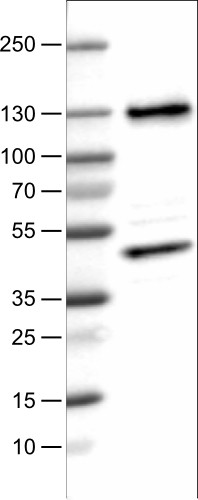 Lane 1: Marker [kDa]<br/>Lane 2: Human cell line U-251 MG