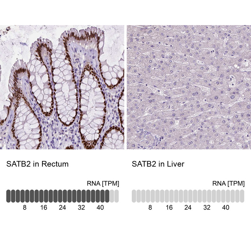 Immunohistochemistry analysis in human rectum and liver tissues using AMAb90678 antibody. Corresponding SATB2 RNA-seq data are presented for the same tissues.