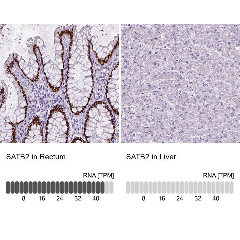 Immunohistochemistry analysis in human rectum and liver tissues using AMAb90679 antibody. Corresponding SATB2 RNA-seq data are presented for the same tissues.