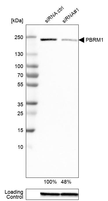 Western blot analysis in RT-4 cells transfected with control siRNA, target specific siRNA probe #1, using Anti-PBRM1 antibody. Remaining relative intensity is presented. Loading control: Anti-GAPDH.