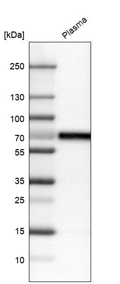 Western blot analysis in human plasma.