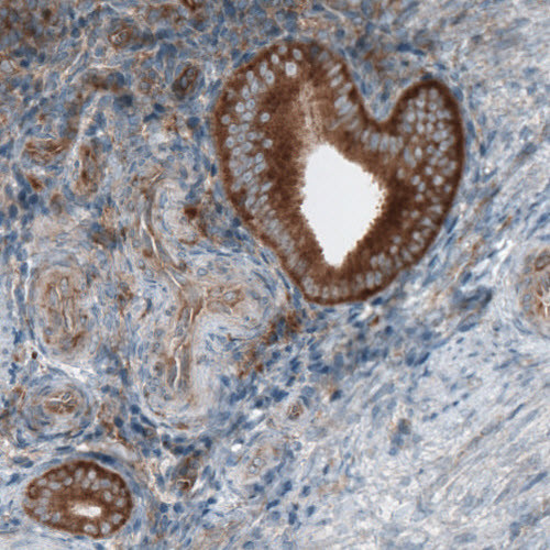 Immunohistochemical staining of human uterus shows cytoplasmic immunoreactivity in the glandular epithelium cells.