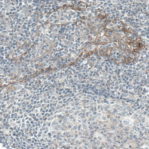 Immunohistochemical staining of human tonsil shows moderate membranous immunoreactivity in squamous epithelial cells.