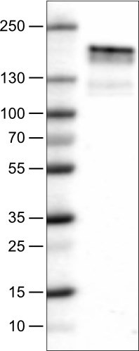 Lane 1: Marker [kDa]<br/>Lane 2: Human cell line A-431