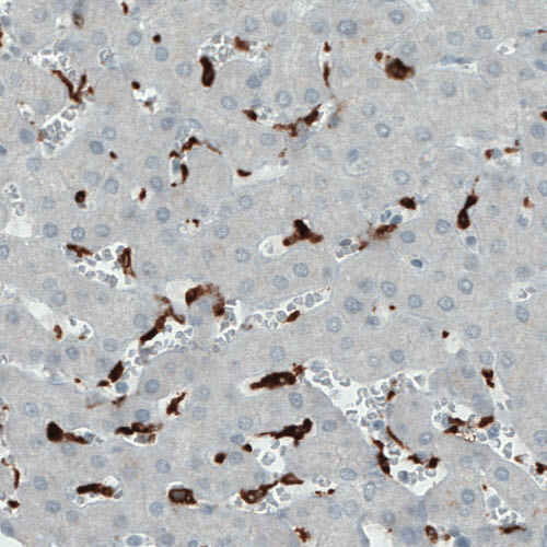 Immunohistochemical staining of human liver shows strong immunoreactivity in Kupffer cells.