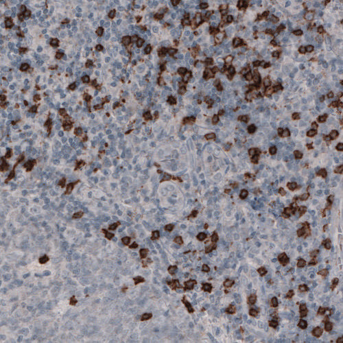 Immunohistochemical staining of human tonsil shows strong immunoreactivity in a subset of lymphoid cells outside the reaction centra.