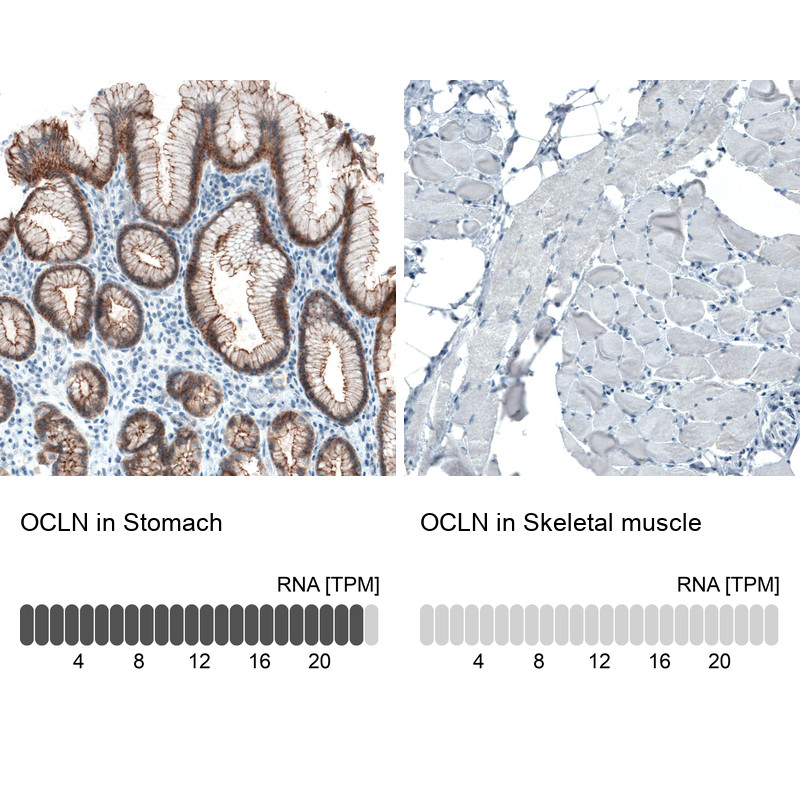 Immunohistochemistry analysis in human stomach and skeletal muscle tissues using AMAb90889 antibody. Corresponding OCLN RNA-seq data are presented for the same tissues.