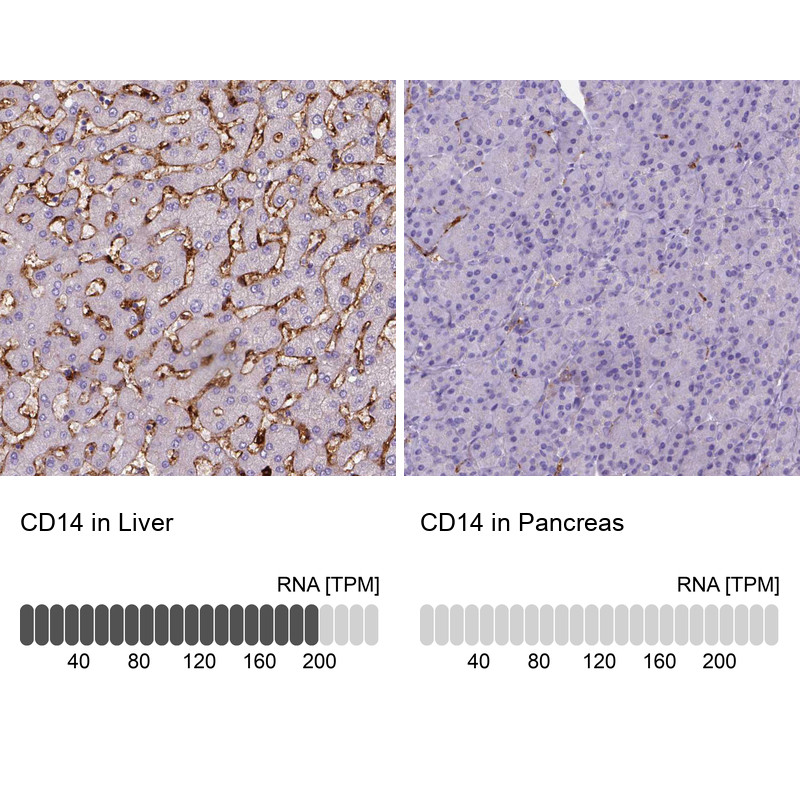 Immunohistochemistry analysis in human liver and pancreas tissues using AMAb90897 antibody. Corresponding CD14 RNA-seq data are presented for the same tissues.