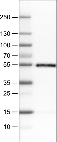 Lane 1: Marker [kDa]<br/>Lane 2: Human tonsil tissue lysate