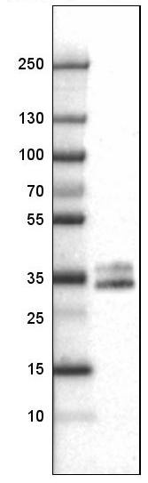 Lane 1: Marker [kDa]<br/>Lane 2: Human spleen
