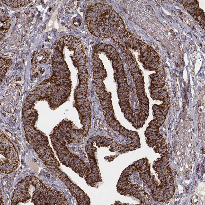 Immunohistochemical staining of human fallopian tube shows strong granular cytoplasmic positivity in glandular cells.