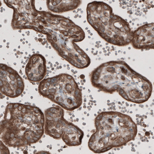 Immunohistochemical staining of human placenta shows cytoplasmic positivity in the trophoblast.